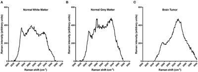 Use of Handheld Raman Spectroscopy for Intraoperative Differentiation of Normal Brain Tissue From Intracranial Neoplasms in Dogs